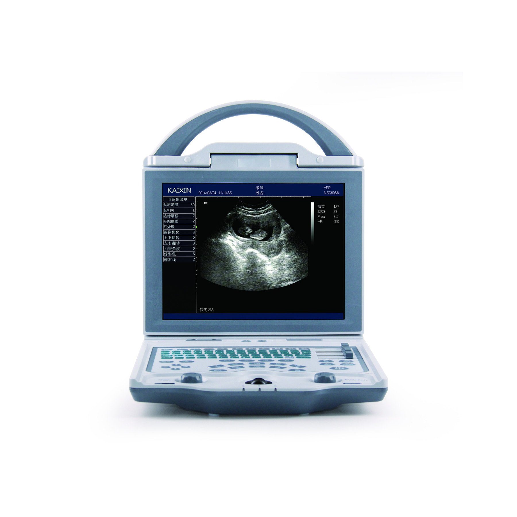 KX5600V Ultrasound-Portable & Reliable with LED & DICOM