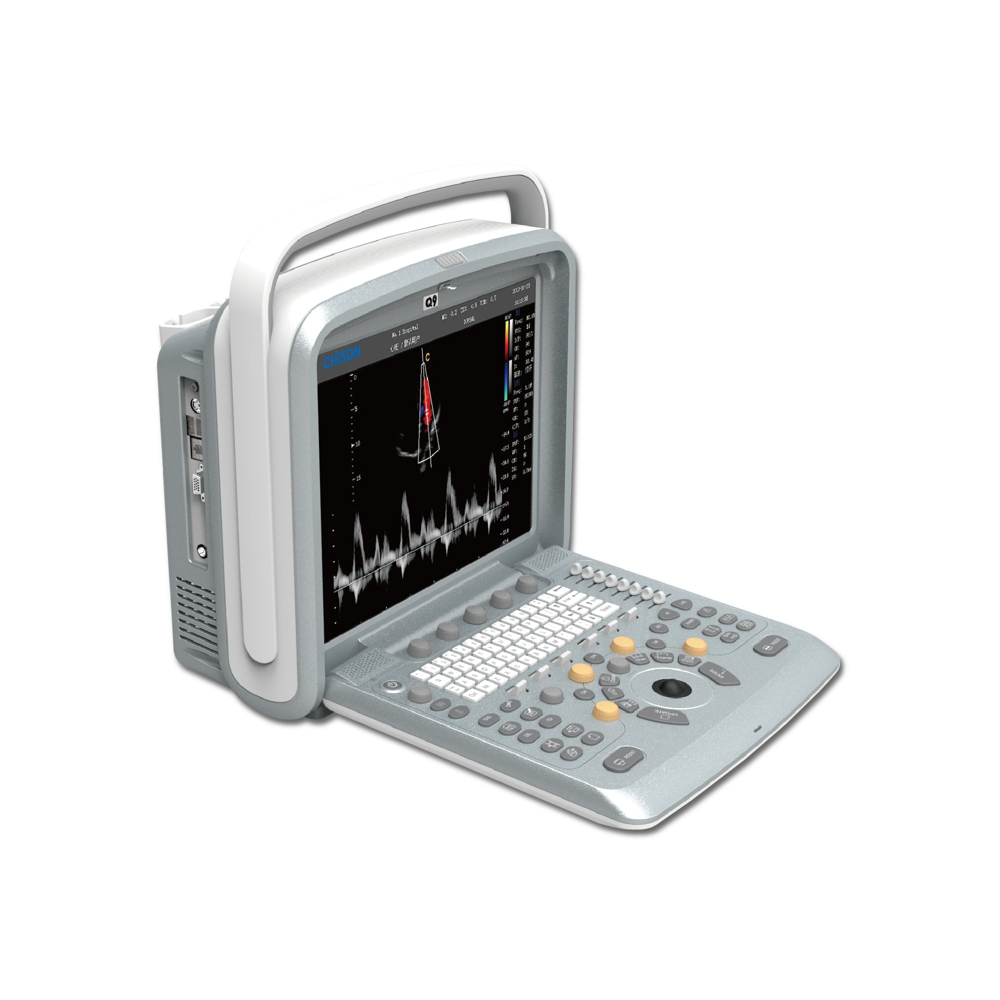Chison Q9V Ultrasound--Masterfully Designed Portable Color Doppler