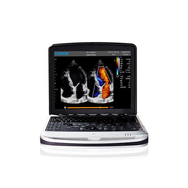 Chison SonoBook9 VET Color Doppler | Veterinary Ultrasounds