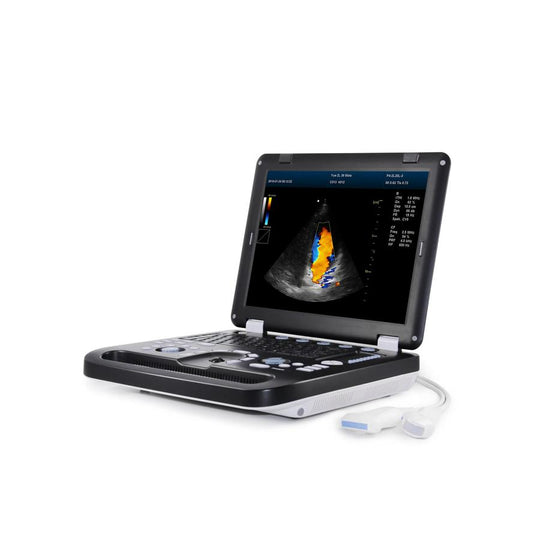 How does a 3D Ultrasound differ from a 4D ultrasound?