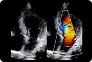 Chison QBit 9 - Deals on Veterinary Ultrasounds
 - 3