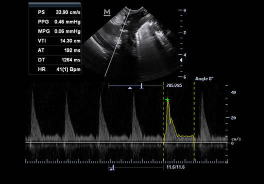 KZ60Vet Color Doppler | Veterinary Ultrasounds