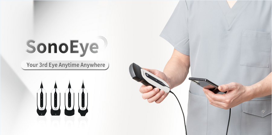 Chison SonoEye P2 VET Linear | Handheld Veterinary Ultrasounds