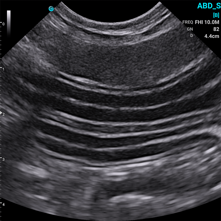 Chison SonoEye VET Handheld Mobile Phone Ultrasound | Veterinary Ultrasounds