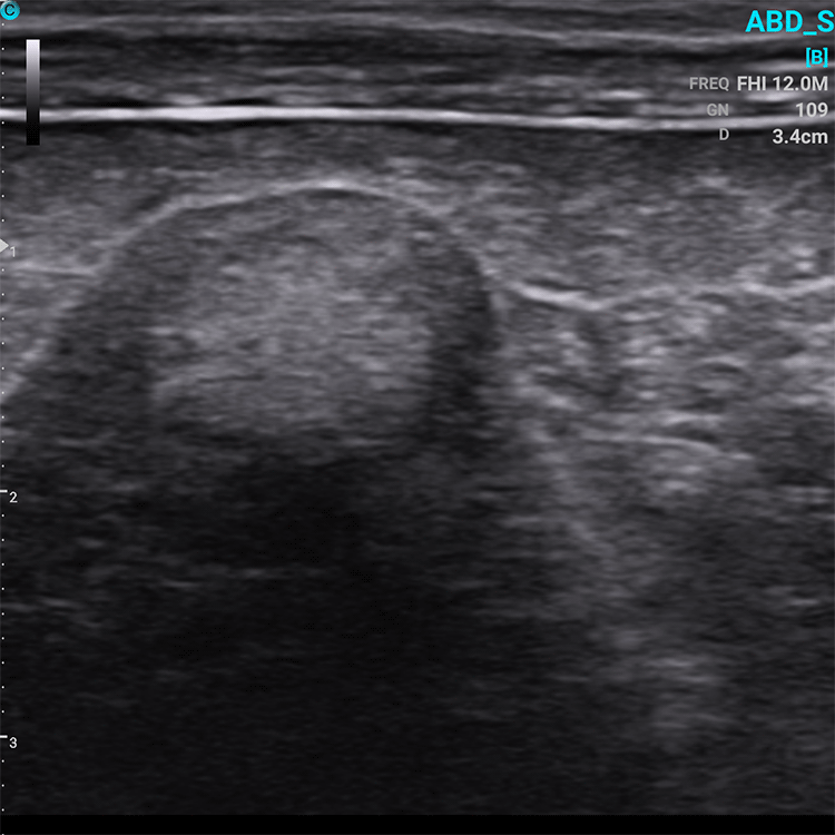 Chison SonoEye VET Handheld Mobile Phone Ultrasound | Veterinary Ultrasounds