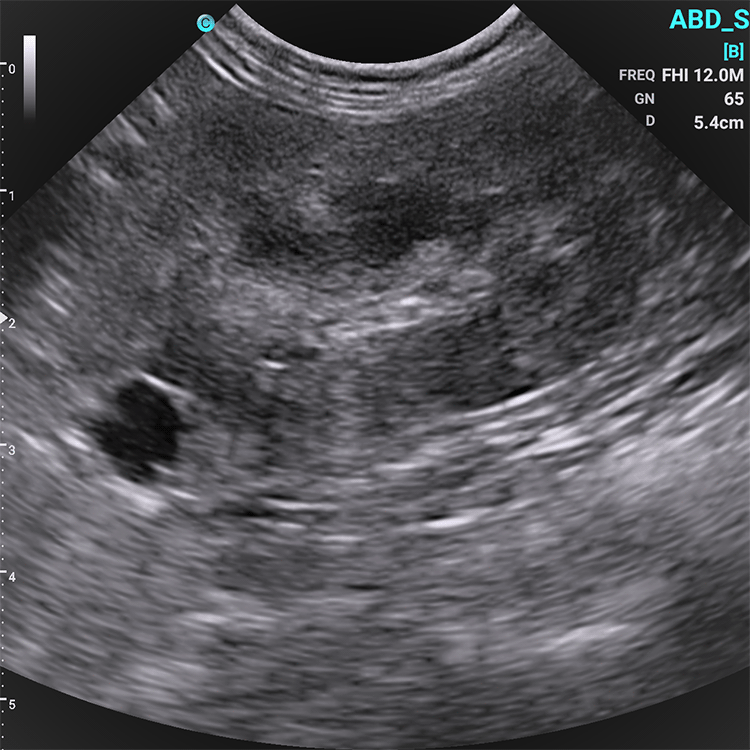 Chison SonoEye VET Handheld Mobile Phone Ultrasound | Veterinary Ultrasounds