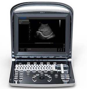 Chison ECO1Vet Demo - Deals on Veterinary Ultrasounds
 - 2