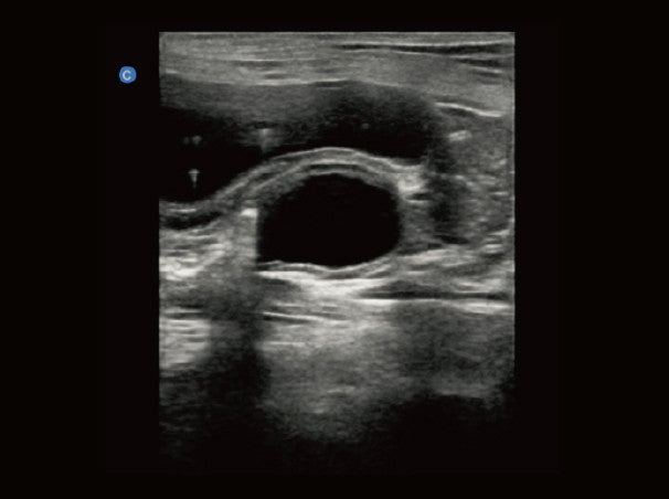 Chison Ebit50Vet--Veterinary Ultrasounds