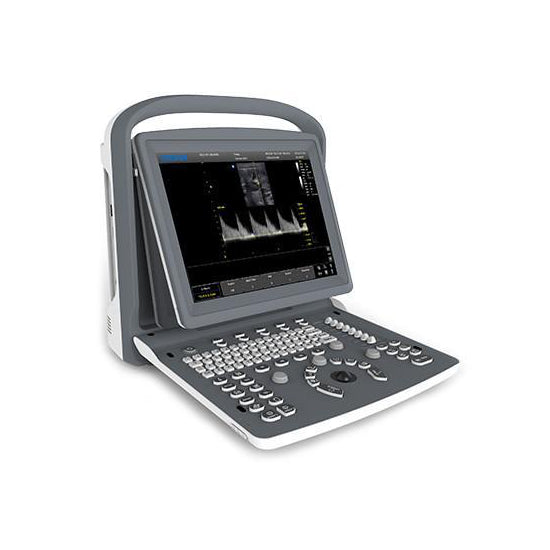 Chison ECO2 VET | USED Veterinary Ultrasounds