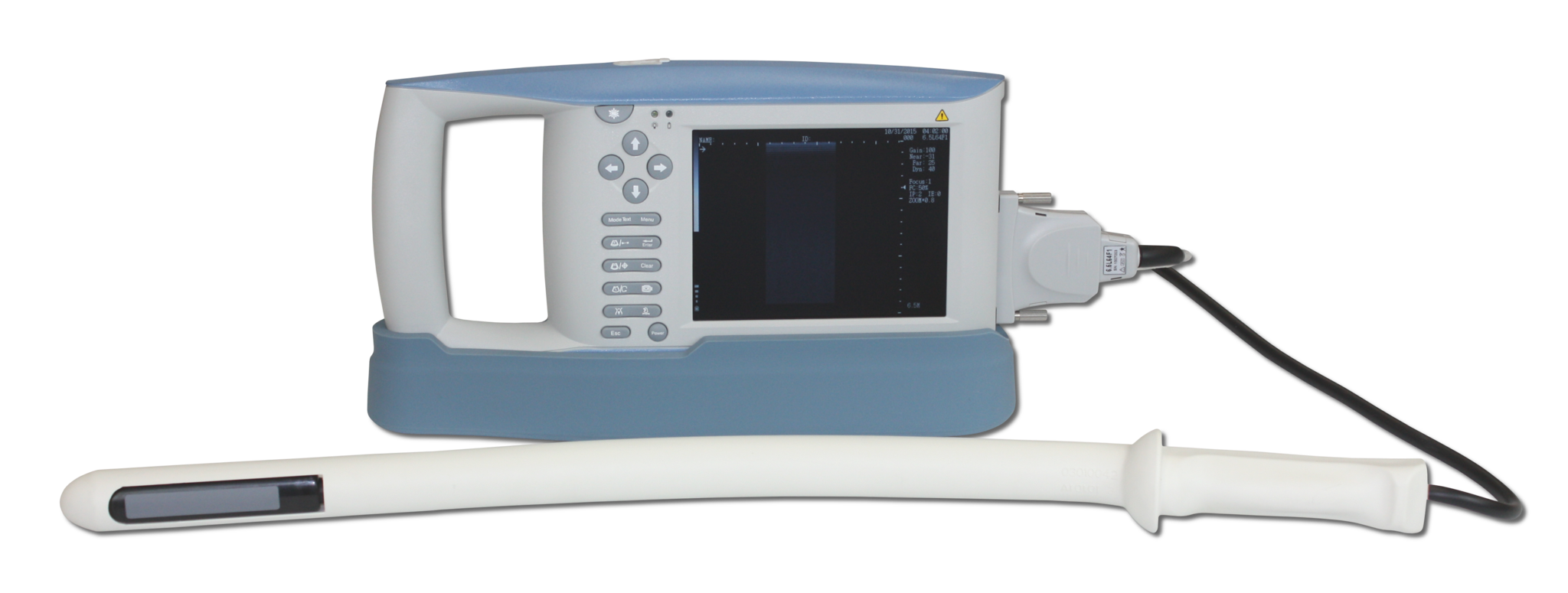Used KX5100V Handheld Ultrasound |Demo Model, Like New, Full Warranty ...