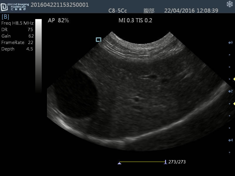 iuStat 100Vet Black & White Veterinary Ultrasound