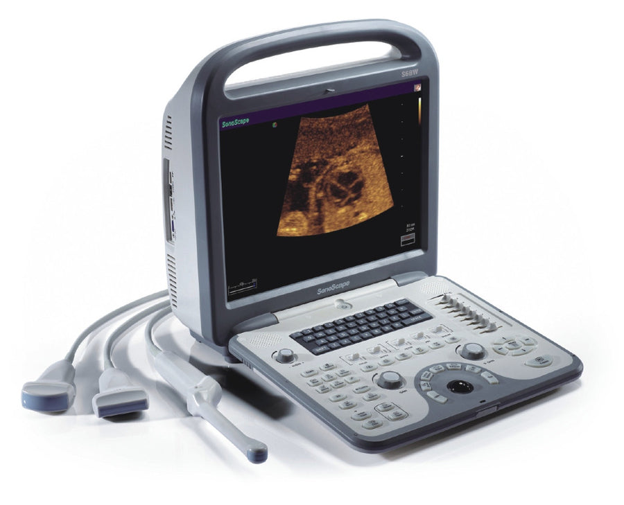 SonoScape S6V Ultrasound - Deals on Veterinary Ultrasounds
 - 2