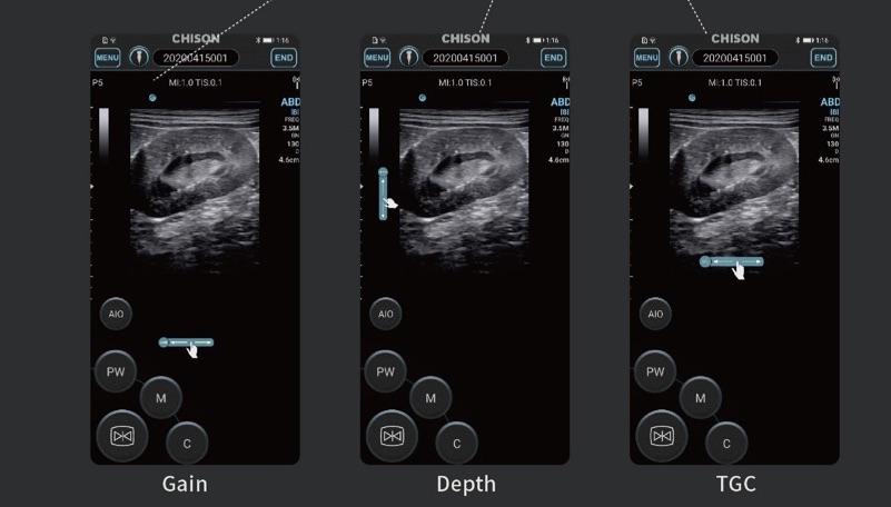 Chison SonoEye VET Handheld Mobile Phone Ultrasound | Veterinary Ultrasounds