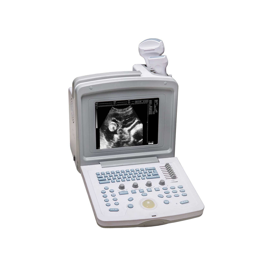 digital veterinary ultrasound scanner with convex probe