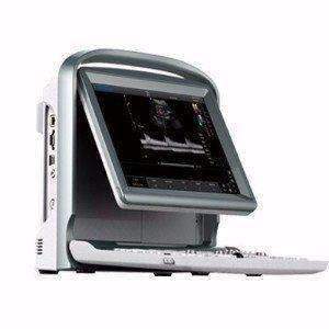 Chison ECO5 Vet Color Doppler Ultrasound | KeeboVet