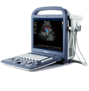 SonoScape S2V Ultrasound - Deals on Veterinary Ultrasounds
 - 1