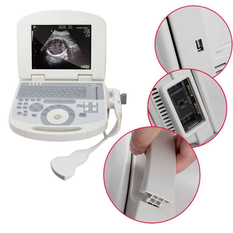 DHL Sale Daptop Digital Prenatal Ultrasound Scanner +Convex probe+Lilon +3D 190891914842