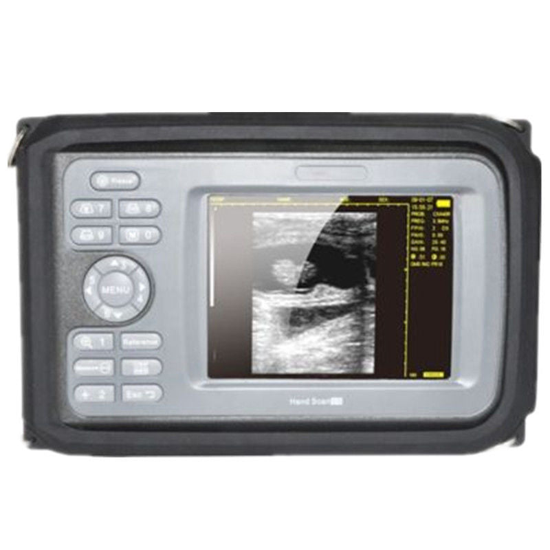 Vet 5.5'' Color Digital PalmSmart Ultrasound Scanner +Rectal Built-in 64 images