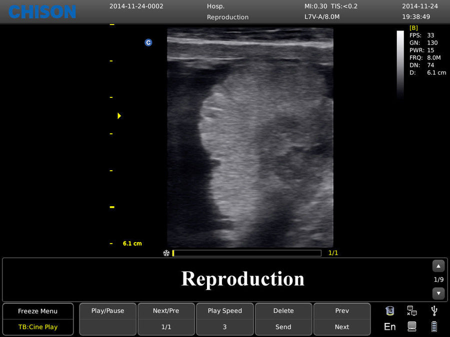 Chison ECO3 Ultrasound w/ 2 Probes and Accredited Veterinary Online Training