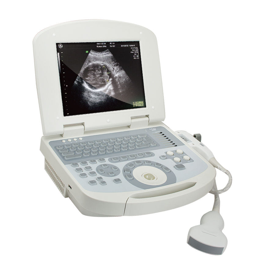 DHL Sale Daptop Digital Prenatal Ultrasound Scanner +Convex probe+Lilon +3D 190891914842