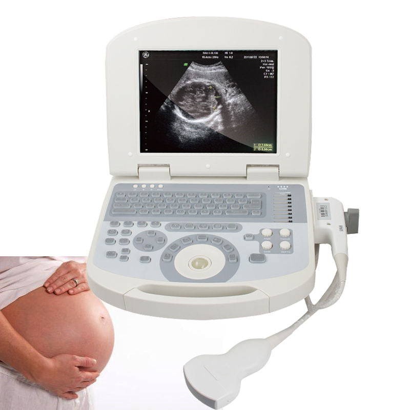 DHL Sale Daptop Digital Prenatal Ultrasound Scanner +Convex probe+Lilon +3D 190891914842