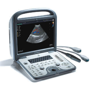 SonoScape S6V Ultrasound - Deals on Veterinary Ultrasounds
 - 3