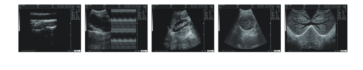 WED-3000V Handheld Vet Ultrasound